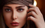 رونمایی سحر قریشی از کبودی چشم هایش با مشت تتلو ! / دروغ یا واقعیت ؟!